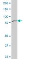 Forkhead Box M1 antibody, H00002305-M09, Novus Biologicals, Western Blot image 