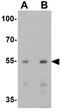 Adhesion Molecule With Ig Like Domain 1 antibody, GTX17210, GeneTex, Western Blot image 