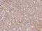 Fermitin Family Member 2 antibody, NBP2-17059, Novus Biologicals, Immunohistochemistry paraffin image 