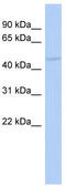 RasGEF Domain Family Member 1C antibody, TA333450, Origene, Western Blot image 