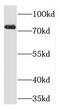 Phospholipase D1 antibody, FNab06530, FineTest, Western Blot image 