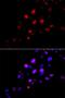 RAD18 E3 Ubiquitin Protein Ligase antibody, LS-C334025, Lifespan Biosciences, Immunofluorescence image 