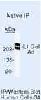 MIC5 antibody, MA5-14140, Invitrogen Antibodies, Immunoprecipitation image 