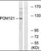 POM121 Transmembrane Nucleoporin antibody, orb178961, Biorbyt, Western Blot image 