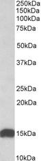 NADH:Ubiquinone Oxidoreductase Subunit S6 antibody, EB09788, Everest Biotech, Western Blot image 