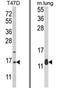 Astrocytic phosphoprotein PEA-15 antibody, AP18148PU-N, Origene, Western Blot image 