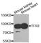 Transferrin Receptor 2 antibody, STJ111887, St John