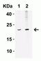 Interferon Beta 1 antibody, NBP1-77288, Novus Biologicals, Western Blot image 
