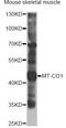Prostaglandin-Endoperoxide Synthase 1 antibody, A7531, ABclonal Technology, Western Blot image 