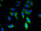 Transient Receptor Potential Cation Channel Subfamily M Member 8 antibody, A51013-100, Epigentek, Immunofluorescence image 