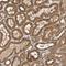 OCRL Inositol Polyphosphate-5-Phosphatase antibody, NBP1-80973, Novus Biologicals, Immunohistochemistry paraffin image 