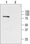 Potassium Voltage-Gated Channel Subfamily J Member 1 antibody, PA5-77570, Invitrogen Antibodies, Western Blot image 