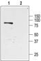 Potassium Voltage-Gated Channel Subfamily J Member 1 antibody, PA5-77570, Invitrogen Antibodies, Western Blot image 