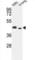 Inositol-Trisphosphate 3-Kinase A antibody, abx033924, Abbexa, Western Blot image 