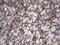 Thyroglobulin antibody, LS-C790191, Lifespan Biosciences, Immunohistochemistry paraffin image 