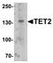 Tet Methylcytosine Dioxygenase 2 antibody, orb75742, Biorbyt, Western Blot image 