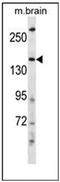 HECT, C2 And WW Domain Containing E3 Ubiquitin Protein Ligase 2 antibody, AP52027PU-N, Origene, Western Blot image 