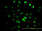 Interferon Related Developmental Regulator 2 antibody, LS-C198506, Lifespan Biosciences, Immunofluorescence image 
