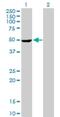 Serine/Threonine Kinase 25 antibody, H00010494-D01P, Novus Biologicals, Western Blot image 