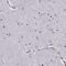 Alpha-N-Acetylgalactosaminidase antibody, PA5-51433, Invitrogen Antibodies, Immunohistochemistry frozen image 