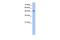 Radical S-Adenosyl Methionine Domain Containing 2 antibody, GTX46969, GeneTex, Western Blot image 