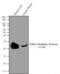 Follicle Stimulating Hormone Subunit Beta antibody, MA5-14711, Invitrogen Antibodies, Western Blot image 