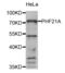 PHD Finger Protein 21A antibody, abx004838, Abbexa, Western Blot image 