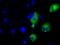 Transforming Acidic Coiled-Coil Containing Protein 3 antibody, NBP2-02619, Novus Biologicals, Immunocytochemistry image 