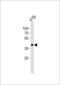 Eukaryotic Translation Initiation Factor 3 Subunit H antibody, MBS9213458, MyBioSource, Western Blot image 