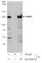 RAD21 Cohesin Complex Component antibody, GTX106012, GeneTex, Immunoprecipitation image 