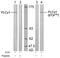 Phospholipase C Gamma 1 antibody, LS-C203003, Lifespan Biosciences, Western Blot image 