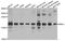 E3 ubiquitin-protein ligase RNF5 antibody, A8351, ABclonal Technology, Western Blot image 