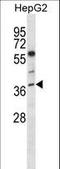 Nei Like DNA Glycosylase 2 antibody, LS-C164823, Lifespan Biosciences, Western Blot image 