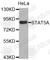 Signal Transducer And Activator Of Transcription 5A antibody, A3638, ABclonal Technology, Western Blot image 