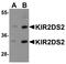 Killer Cell Immunoglobulin Like Receptor, Two Ig Domains And Short Cytoplasmic Tail 2 antibody, A03789, Boster Biological Technology, Western Blot image 