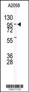 Ubiquitin Specific Peptidase 5 antibody, 61-098, ProSci, Western Blot image 