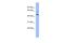 Zinc Finger Protein 215 antibody, A14095, Boster Biological Technology, Western Blot image 