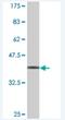 Trinucleotide Repeat Containing Adaptor 6B antibody, H00023112-M02, Novus Biologicals, Western Blot image 