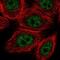 Vitamin D Receptor antibody, NBP2-55786, Novus Biologicals, Immunofluorescence image 