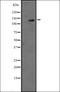 Adenylate Cyclase 3 antibody, orb335182, Biorbyt, Western Blot image 