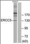 ERCC Excision Repair 5, Endonuclease antibody, orb137586, Biorbyt, Western Blot image 