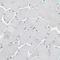 Unc-5 Family C-Terminal Like antibody, NBP2-47585, Novus Biologicals, Immunohistochemistry paraffin image 