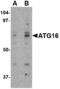 Autophagy Related 16 Like 1 antibody, A00526-1, Boster Biological Technology, Western Blot image 