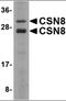 COP9 Signalosome Subunit 8 antibody, orb89819, Biorbyt, Western Blot image 