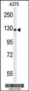 Nuclear Factor Kappa B Subunit 2 antibody, LS-C164502, Lifespan Biosciences, Western Blot image 