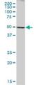 Cytochrome P450 Family 2 Subfamily A Member 6 antibody, H00001548-B01P, Novus Biologicals, Western Blot image 