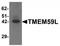 Transmembrane Protein 59 Like antibody, TA319872, Origene, Western Blot image 