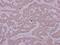 Phosphate Cytidylyltransferase 2, Ethanolamine antibody, PA5-28047, Invitrogen Antibodies, Immunohistochemistry frozen image 