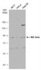 Inhibitor Of Nuclear Factor Kappa B Kinase Subunit Beta antibody, NBP1-32258, Novus Biologicals, Western Blot image 
