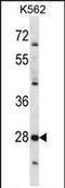 Serine protease 27 antibody, PA5-71922, Invitrogen Antibodies, Western Blot image 